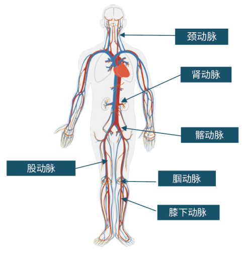 禄游®Luvjour 外周球囊扩张导管(图2)